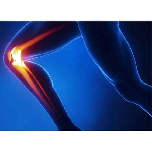 medical premium, bienestra e innovación a tu alcance, rodilla, lesiones de rodilla