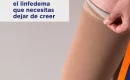 10 mitos sobre el linfedema que necesitas dejar de creer