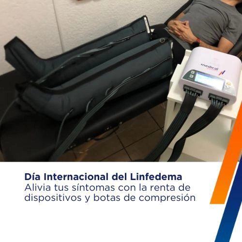 Terapia de compresión personalizada para tratamiento de linfedema